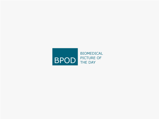 BPoD